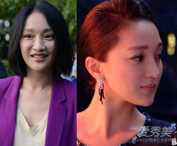 不整容不是好演员！柳岩张天爱容貌变化惊人 女明星整容前后