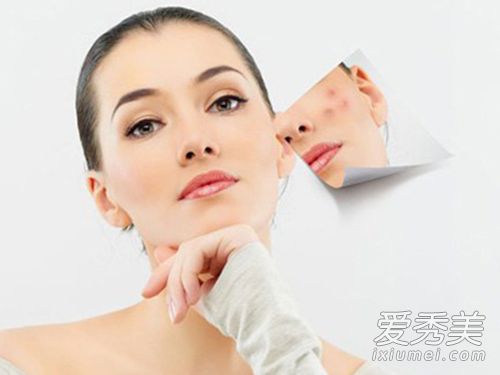 痘印全无 在家就能去痘印 去痘印的方法