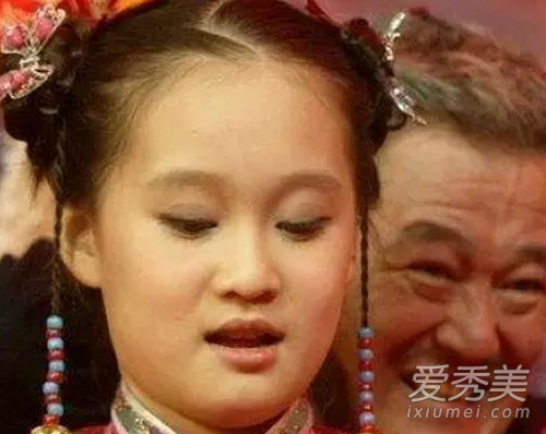 赵本山女儿大变脸 是美丽还是整容过度 明星整容前后照片对比
