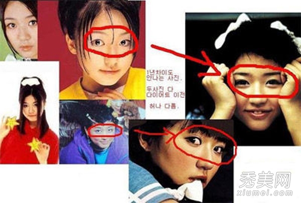 《想你》尹恩惠 五官整形对比照曝光