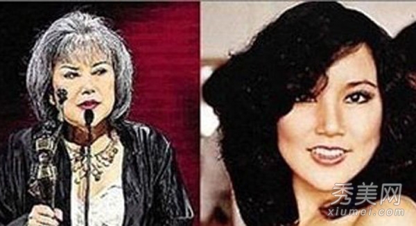 明星爱美整容失败 轻者毁容重者丧命