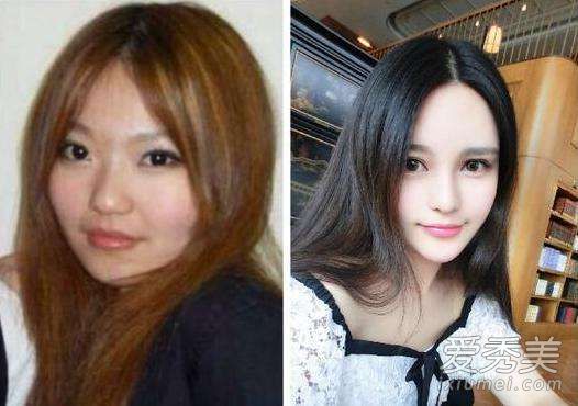 只是微整也就算了 但这些女星简直就是换头啊！ 哪些女明星整过容