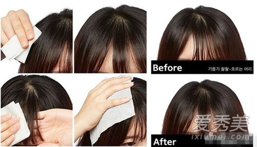 头发老是出油是什么原因 头发油可以用湿纸巾擦去油吗