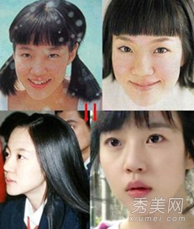 韩国女星假脸走天下 整容对比照判若两人