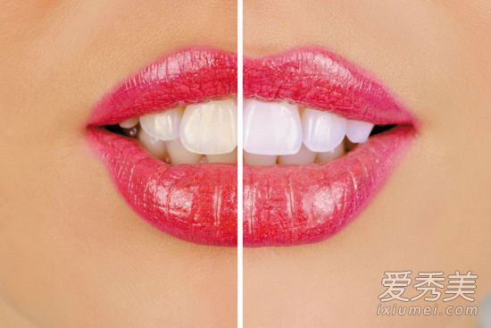 牙齿黄怎么办小偏方 牙齿黄了怎么变白