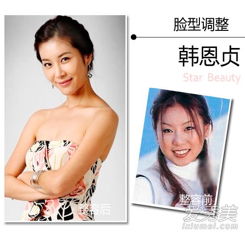 美女的诞生靠整容？韩国女星整容位置大揭秘 明星整容前后照片对比