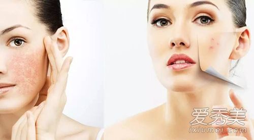 天啊我为什么会变成敏感肌 这些毁容破事你还在做多少 敏感肌的原因