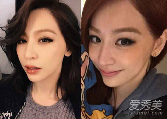 娛樂圈“左臉控”女明星 右臉為何不敢示人？ 左臉控女星