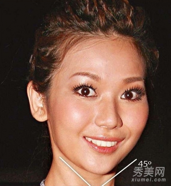 香港女星整容+化妆 V字脸变脸对比照