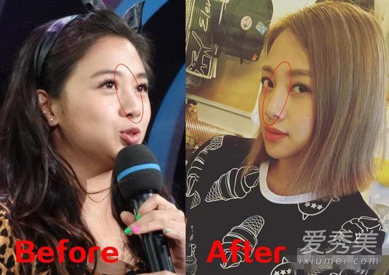 只是微整也就算了 但这些女星简直就是换头啊！ 哪些女明星整过容