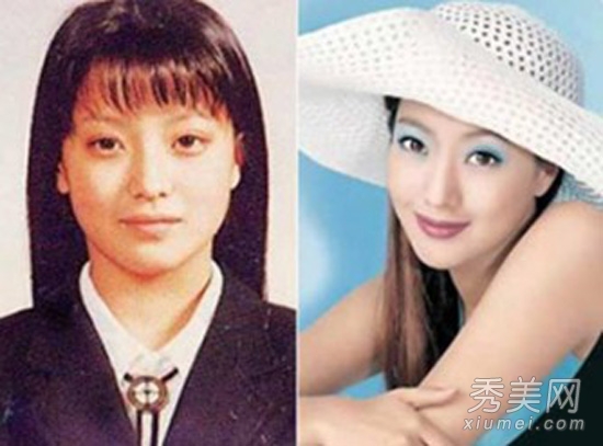 25位韩国女星 出道前整容对比图