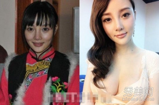 12位女星疑整容失败 杨怡萧蔷被“毁容”