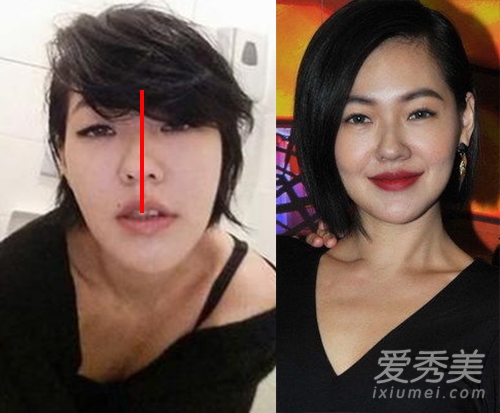 杨子姗霍建华小S萧蔷 鼻子歪天生or整容？