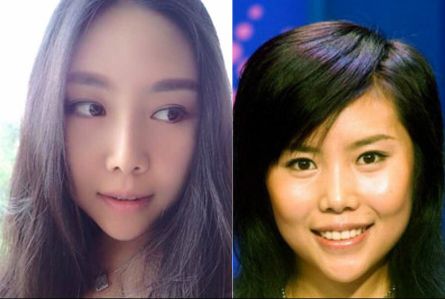 纪敏佳结婚啦！单看照片差点忘记她变脸前的样子了 纪敏佳整容前后照片