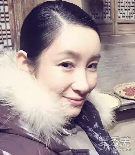 秦海璐为单眼皮投保百万 为啥又要割双眼皮呢？ 秦海璐割双眼皮