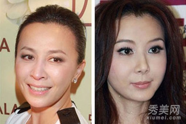 同龄女星容貌差太多 化妆or整容？