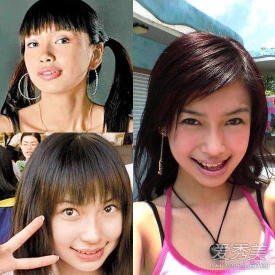 怀孕后的baby越来越美 都说女大18变她这简直是72变啊！ angelababy整容前后照片