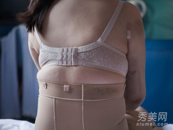摄影师跟拍：韩国女子整容手术后恐怖模样