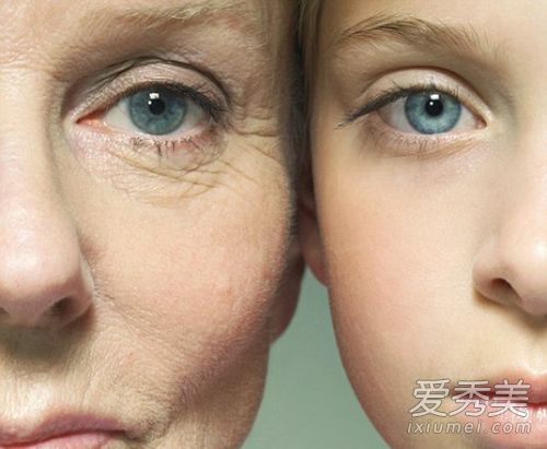 預防皮膚長皺紋 吃什麼清除自由基？ 女人吃什麼抗衰老