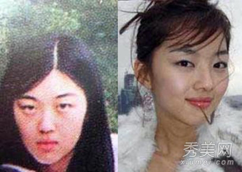 韓國女星整容後遺症 童顏少女變少婦