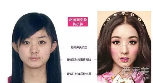 颜值低+不整容 赵丽颖靠造型逆袭变美（图） 赵丽颖今昔对比