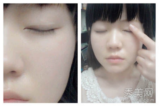 双眼皮贴怎么贴？图解5步大眼妆画法