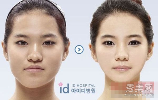 韓國醫院公開整容照 神奇整形術驚呆小夥伴