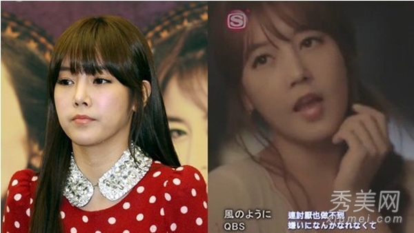 T-ara成员素妍 承认隆鼻后又面部整形