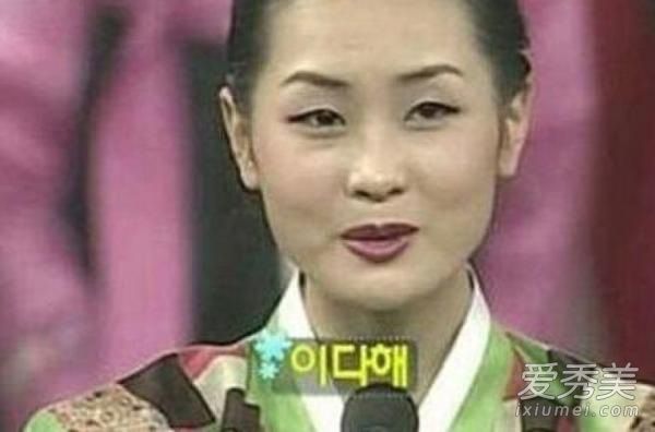 高胜美整容脸僵 图揭日韩女星整容变脸术 明星整容前后照片