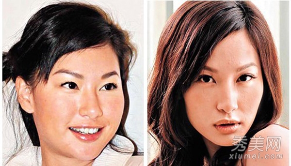 TVB二线女星“变脸”被爆整容上瘾