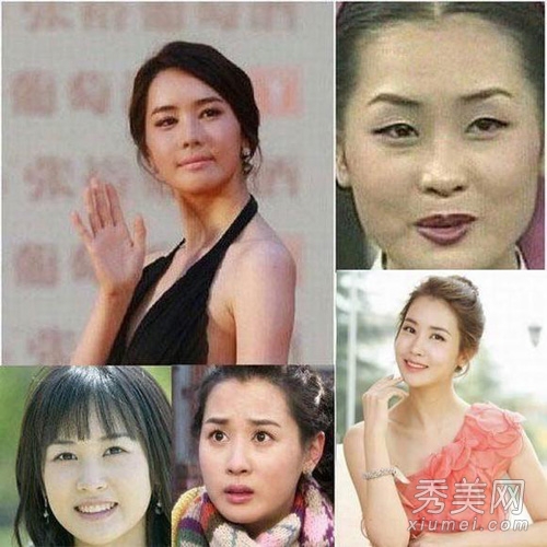 蔡妍尹恩惠 15位韩女星旧照揭秘整容历程