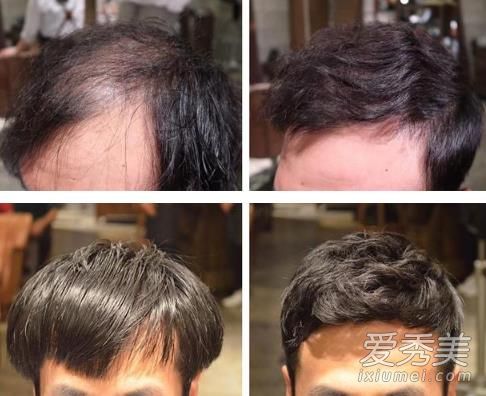 胡歌心形发际线正常吗 男士头发少发际线高适合什么发型