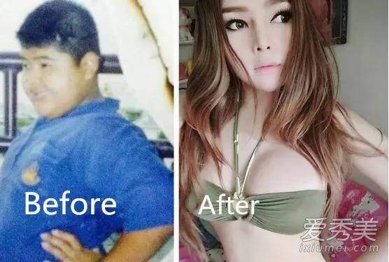 泰國肥宅變臉史 74萬泰銖整容變網紅 泰國男子整容前後