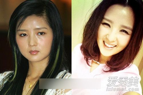 女星容貌变迁 尚雯婕锥脸庄思敏变妖怪 明星整容前后照