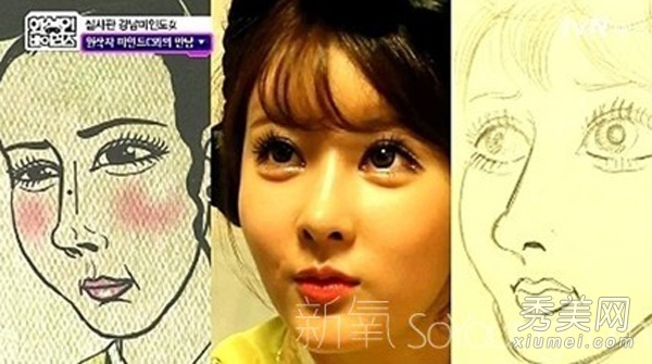 韓國女子愛上整容 28次整容變漫畫肉臉