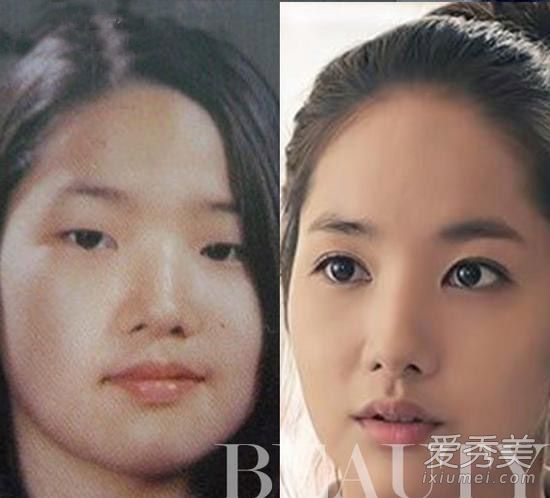 “整容最厲害”的韓國女星樸敏英終成大美女 樸敏英整容前後對比