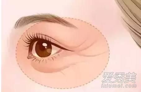 整形小常识：7大眼部手术你了解多少？ 眼部整形手术