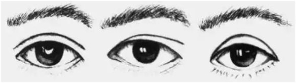整形小常識：7大眼部手術你了解多少？ 眼部整形手術