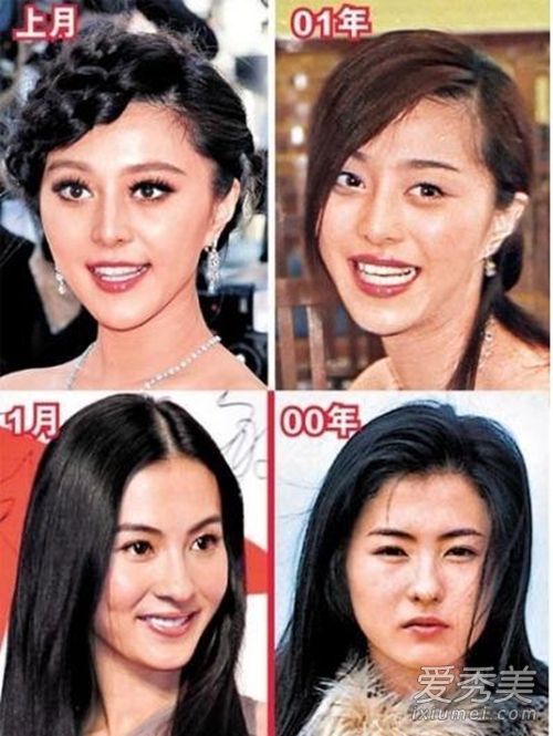 梁静茹的脸怎么“一言难尽” 她又整了哪里？ 明星整容前后对比照