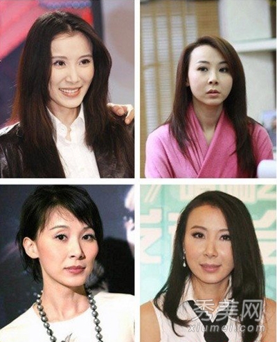 林誌玲蕭薔 女星打玻尿酸整容前後對比