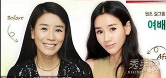 7大韩星被传整容 韩国小姐金有美勇敢承认