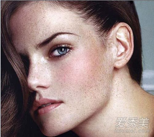 一斑毁所有 脸上雀斑到底怎么回事？ 雀斑是怎么形成的