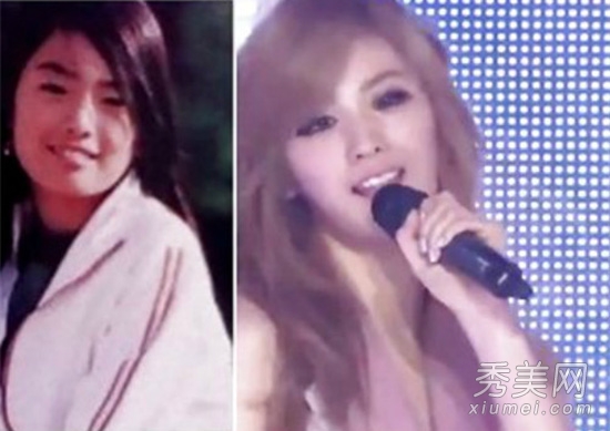 韓國第一美女 Nana整容前後對比照