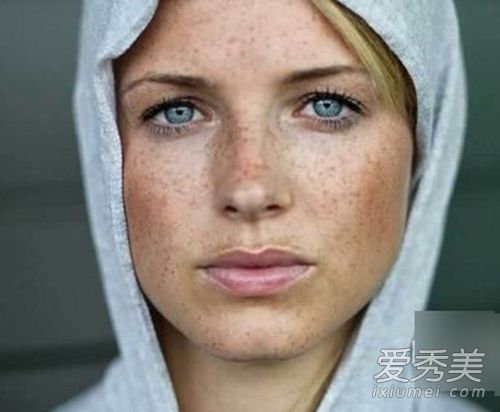 脸上的斑点你有多了解 四种斑点解析 色斑形成的原因