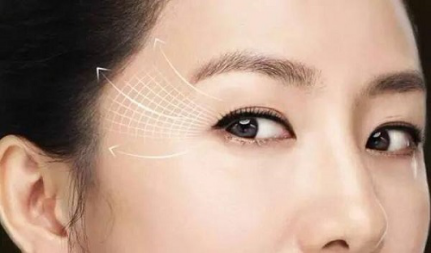 30歲眼角有皺紋怎麼辦 美姿爾幹細胞讓肌膚煥然新生
