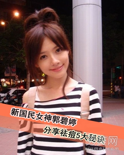“国民女神”郭碧婷 瓷白美肌5大祛痘秘笈