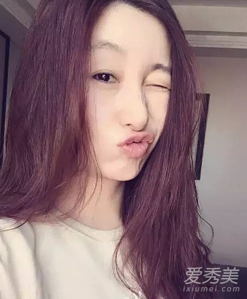 秦海璐为单眼皮投保百万 为啥又要割双眼皮呢？ 秦海璐割双眼皮