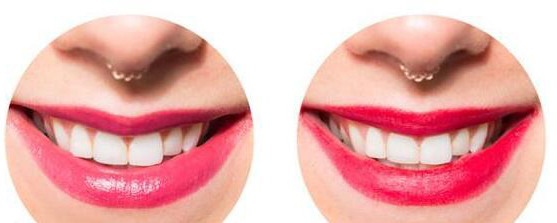 唇膏颜色：什么颜色的口红显牙白？ 什么颜色口红显白