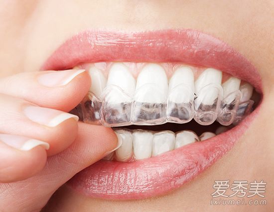 年龄越大牙齿越黄 5个小妙招防止牙齿变黄 牙齿黄怎么办