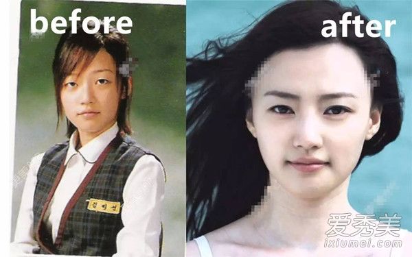 说好的零整容又让你们失望了！黄轩女友换脸史惊人 整过容的女明星